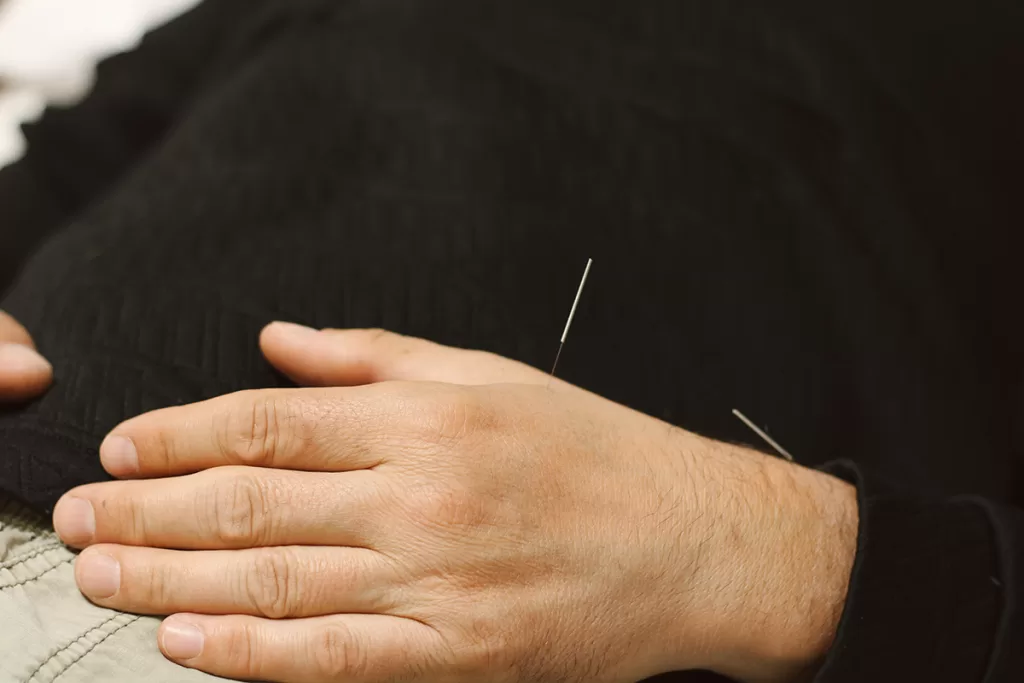 Acupuncture treatment